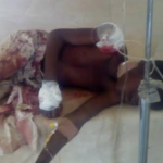 Customs stray bullet injures primary six pupil in Katsina