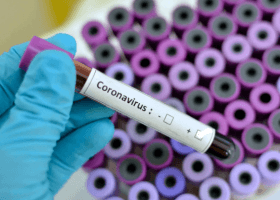 Coronavirus: FG steps up vigilance at entry points