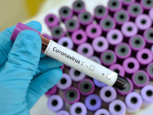 Coronavirus: FG steps up vigilance at entry points  