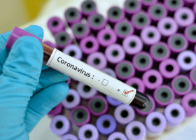 Nigerian tests positive to coronavirus in U.S.