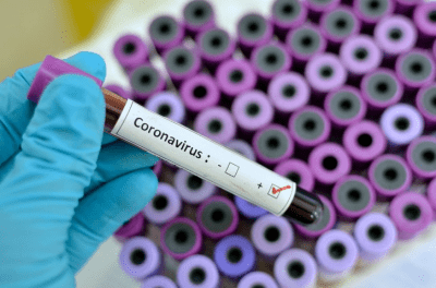 Nigerian tests positive to coronavirus in U.S.