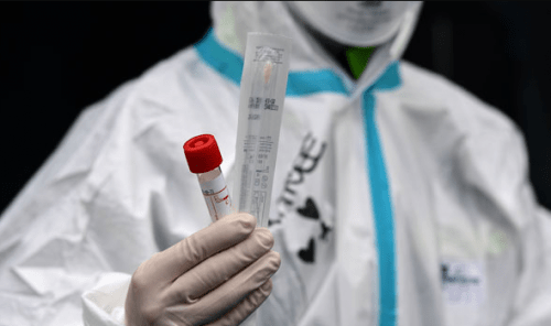 Nigeria’s covid-19 cases rise to 174