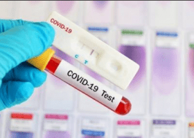 Nigeria records 22 new COVID-19 cases, total now 276