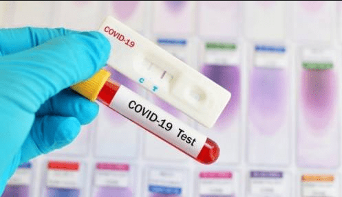 Nigeria records 22 new COVID-19 cases, total now 276