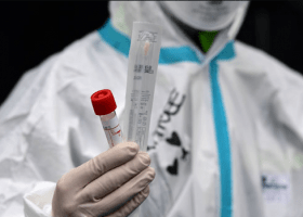 Nigeria’s covid-19 cases rise to 174