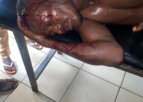 PHOTOS: Smugglers brutalise Customs officer in Katsina