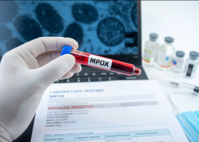 Ports Screen Seafarers for Mpox Amid New Strain Detection