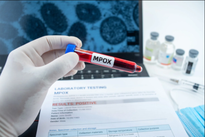 Ports Screen Seafarers for Mpox Amid New Strain Detection